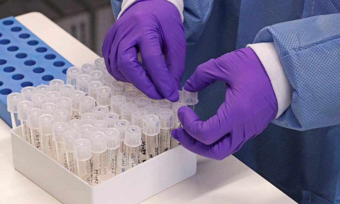 Pesquisadores estudam moléculas de medicamentos que atacam coronavírus