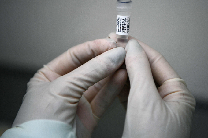 Niterói vai fazer teste de covid-19 em todos os pacientes com sintomas
