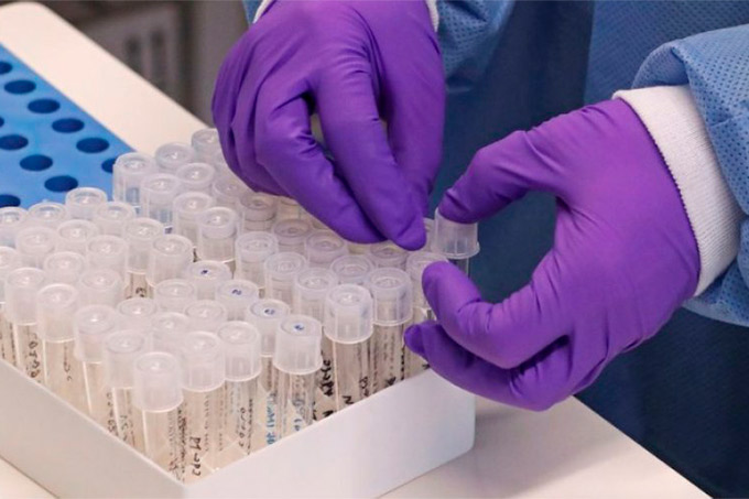 Bahia: 63 pessoas foram curadas do Covid-19