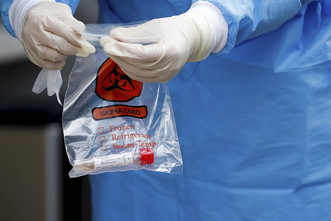 Brasil poderá realizar até 50 mil testes de Covid-19 por dia