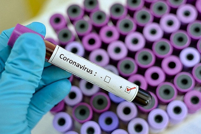 Brasil tem quase 300 mil casos de coronavírus, diz estudo