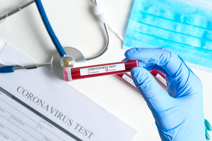 Camaçari contabiliza 15º casos confirmados do novo coronavírus