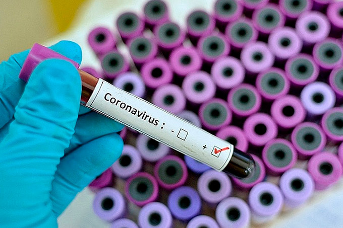 Covid-19: Brasil tem 3.670 mortes e 52.995 casos confirmados