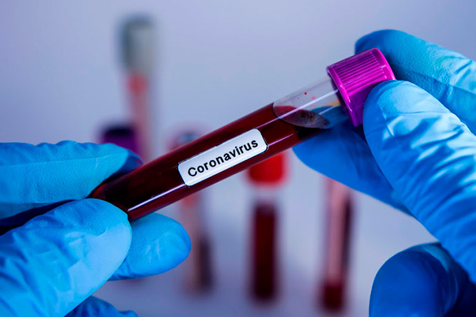 Camaçari contabiliza 35 casos confirmados de Coronavírus (Covid-19)