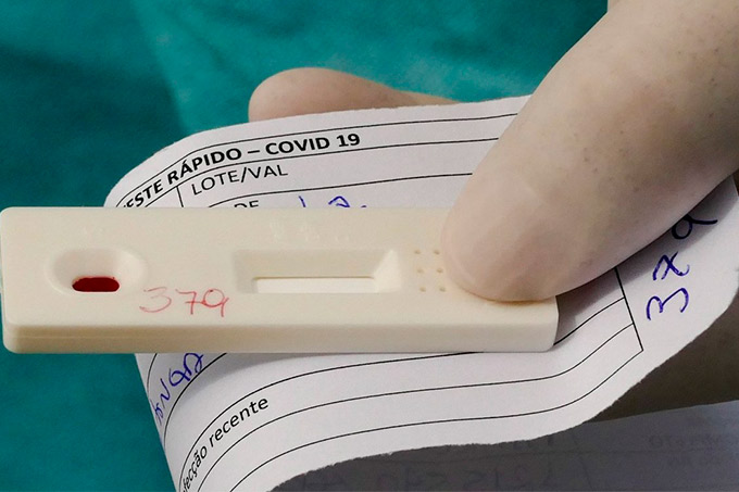 Anvisa aprova realização de testes rápidos de coronavírus em farmácias