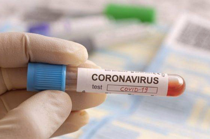 Boletim Epidemiológico de Camaçari registra 29 casos recuperados