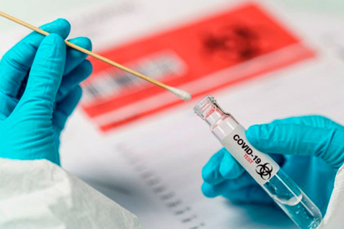 Prefeitura adquire testes que identificam presença ativa do Covid-19