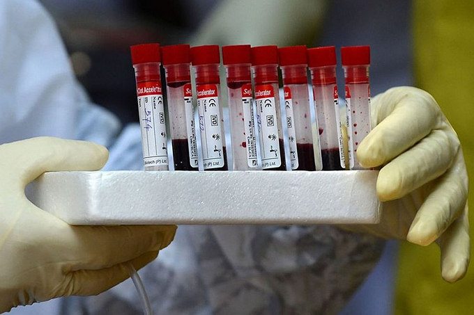 Bahia tem 170 mortes e 4.745 casos confirmados da covid-19