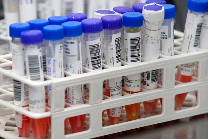Brasil supera Alemanha e já é o 7º país em número de casos