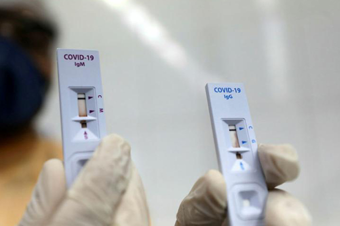 Farmácias começam a venda de testes rápidos nesta sexta