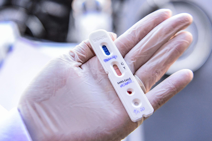Covid-19: testes positivos em jovens entre 20 e 29 anos crescem 180% em Feira