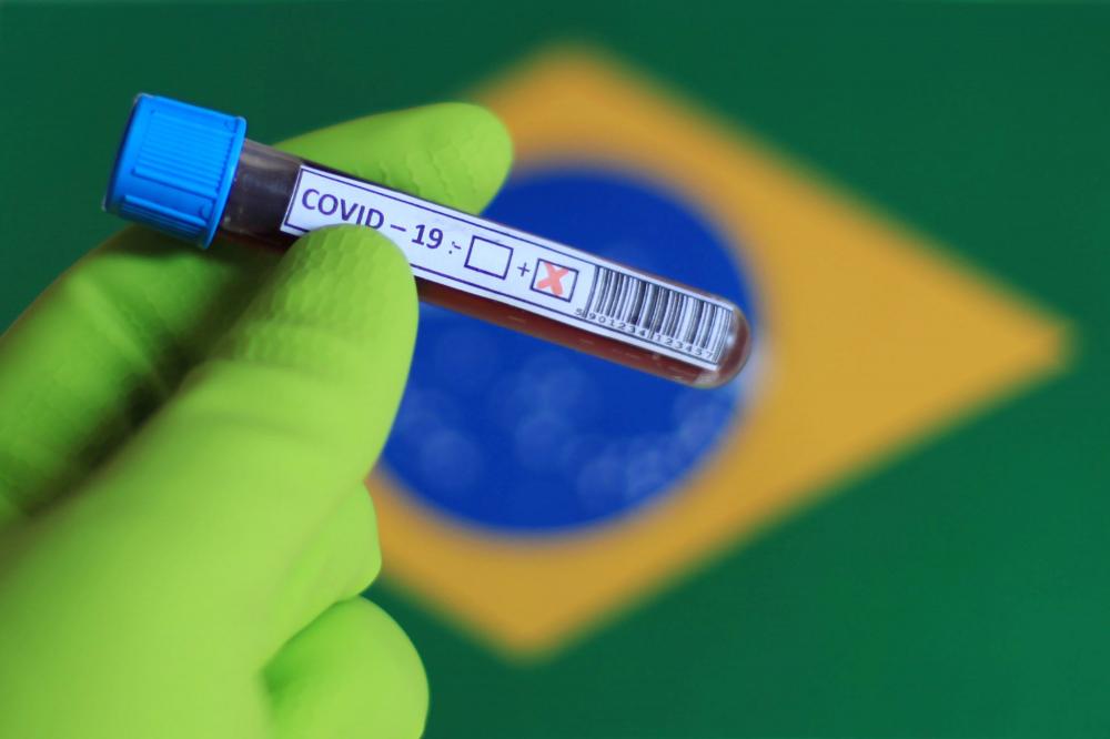 Pesquisa aponta aumento de 53% de brasileiros com anticorpos de Covid-19