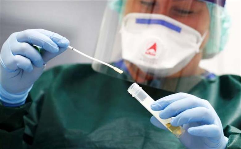 Brasil registra 612 mortes por covid-19 em 24h; total vai a 43.332
