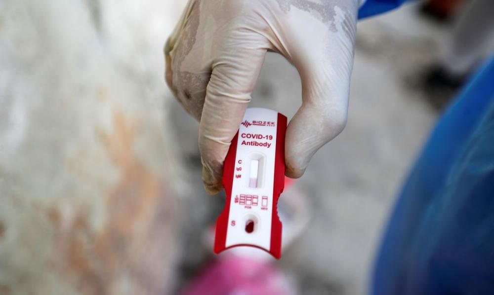 Governo anuncia parceria para produzir vacina contra covid-19 