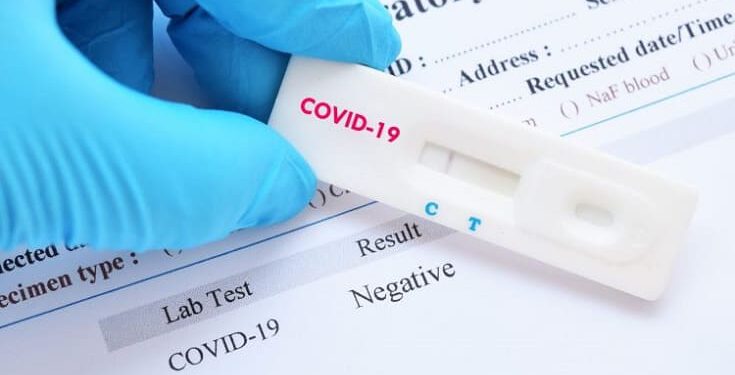 Mata de São João confirma mais 23 novos casos de Covid-19