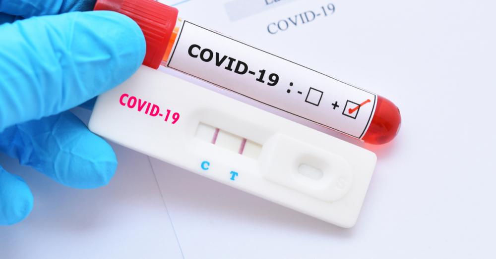 ANS decide se testes para covid-19 continuam obrigatórios