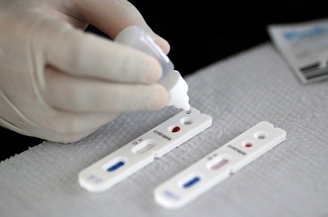 Ministério da Saúde obriga laboratórios a notificar em até 24h resultados de testes da Covid-19