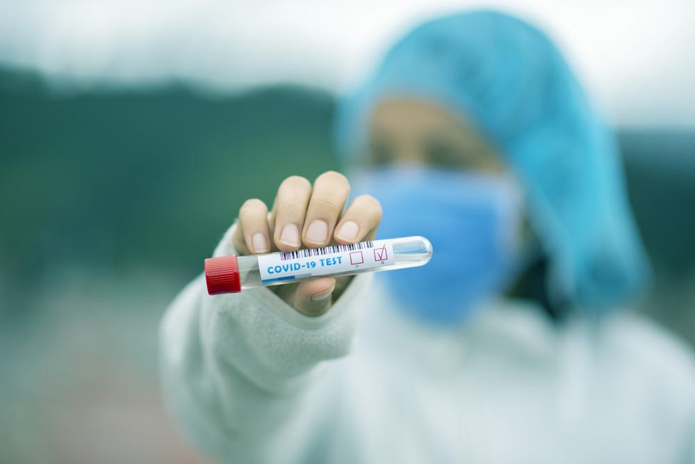 Estudo da USP confirma caso de reinfecção por coronavírus