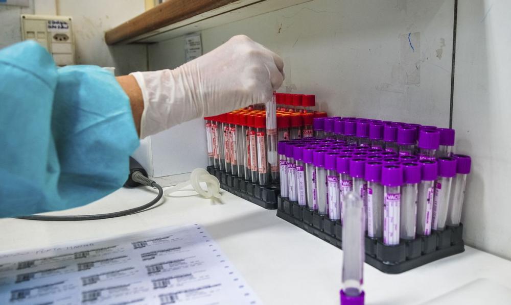 UFRJ desenvolve teste sorológico 20 vezes mais barato