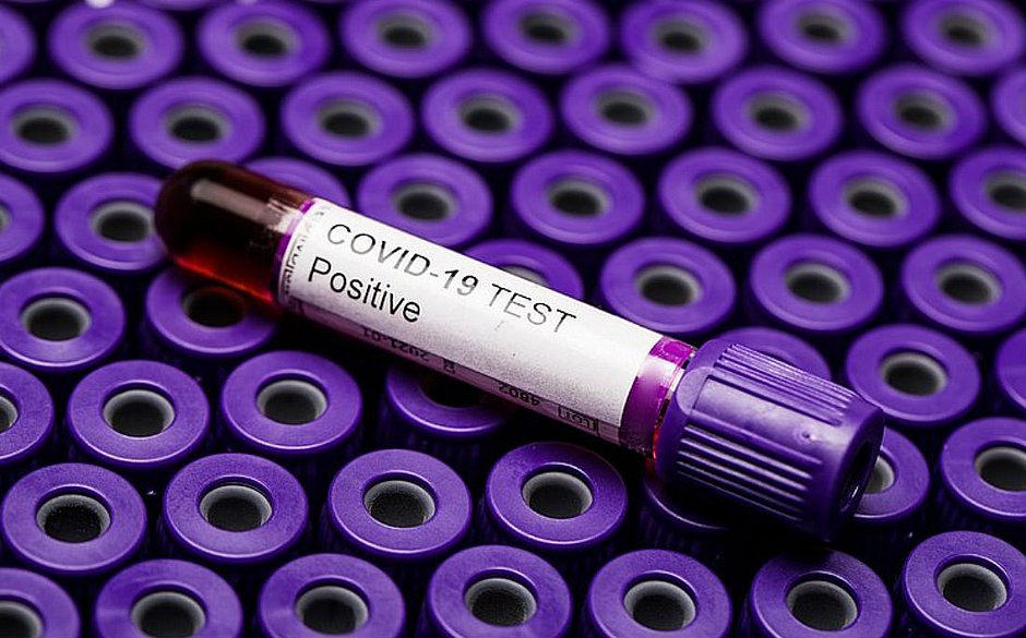 Bahia registra 31 mortes e 1.048 casos de covid-19 em 24 horas