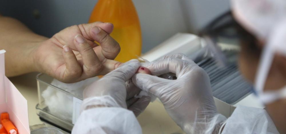 Bahia registra 48 mortes e 693 novos casos de covid-19 em 24h
