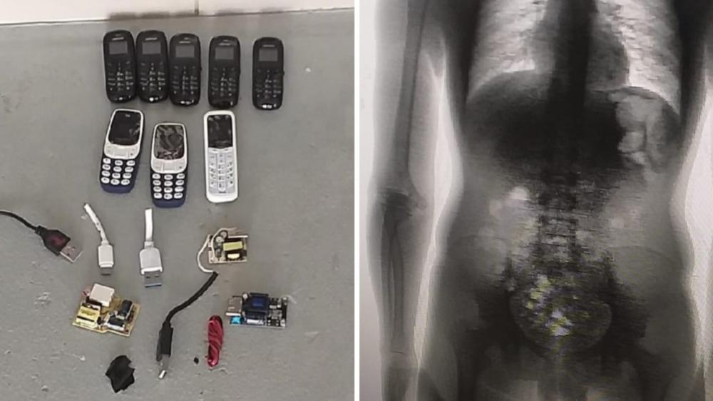 Preso é flagrado com 8 celulares, carregadores e chips dentro do corpo
