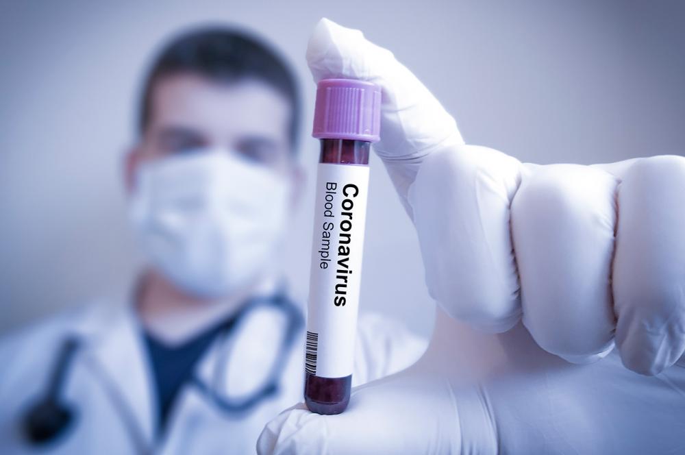 Com 6.634 infecções pela Covid-19, Reino Unido registra recorde de casos diários