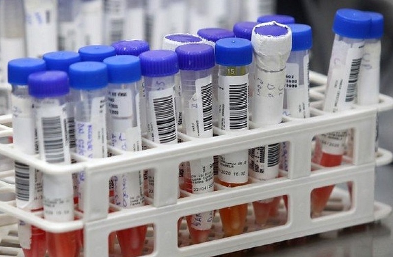 Bahia registra 28 mortes e 565 novos casos de covid-19 em 24h