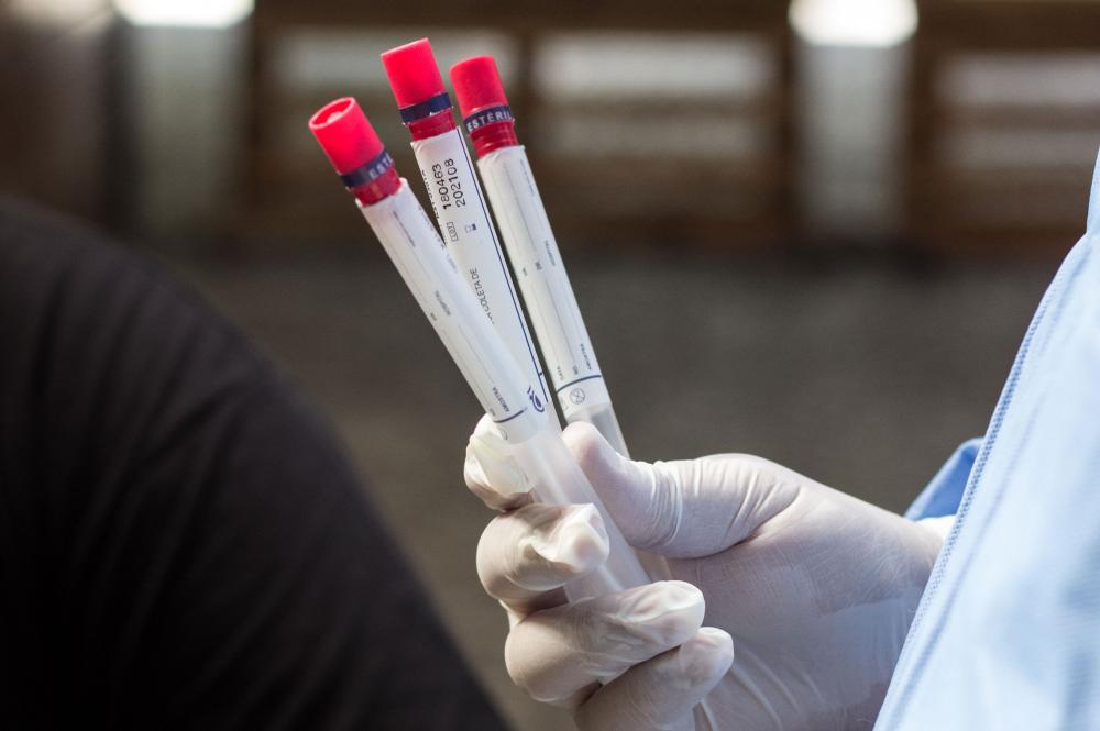 Brasil ultrapassa marca de 150 mil mortes por covid-19