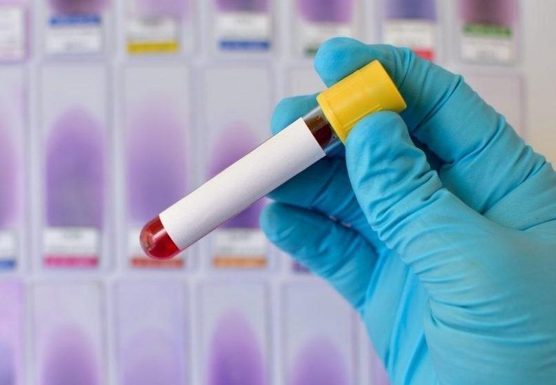 Estudo liga menor risco de infecção por Covid-19 ao tipo sanguíneo O