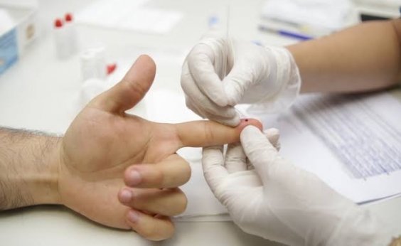 Brasil registra 158.611 mortes por Covid-19, diz consórcio de imprensa