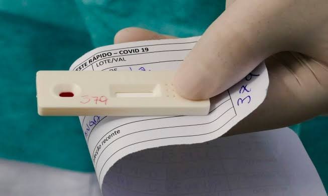 Bahia registra 24 mortes e 712 novos casos de covid-19 em 24h