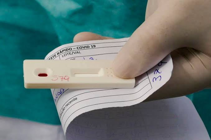 Bahia registra 3.118 novos casos de covid-19 nas últimas 24h