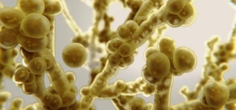Anvisa alerta para possível primeiro caso de fungo fatal resistente a medicamentos no Brasil