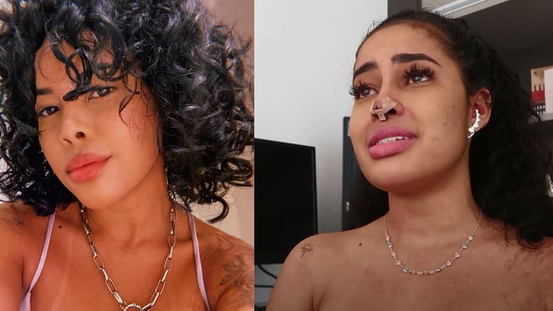 Sthefane Matos revela drama após complicação com plástica; veja vídeo