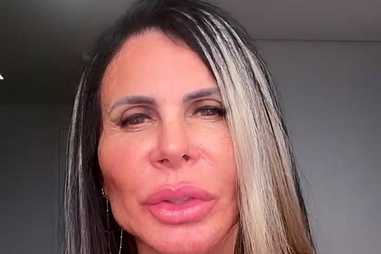 Gretchen rebate críticas após harmonização: 