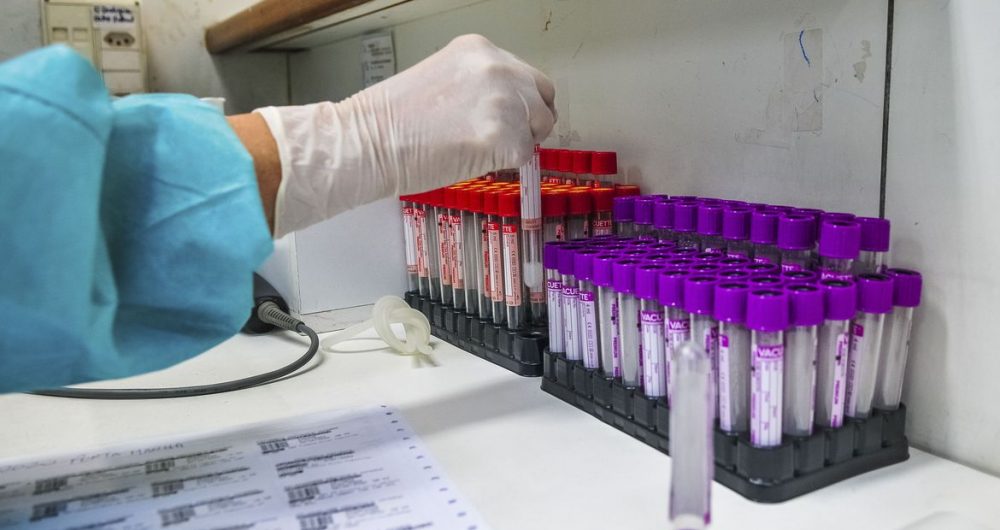 Bahia registra 3.206 novos casos de covid-19 em 24h
