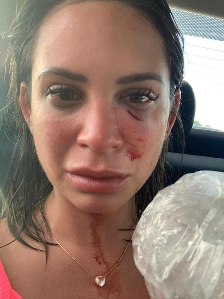 Turistas são agredidos por empresário em resort de luxo Vila Galé