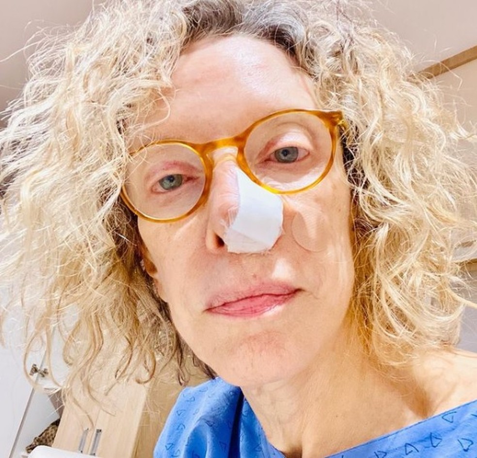 Marília Gabriela descobre câncer no nariz e passa por cirurgia para retirada de tumor