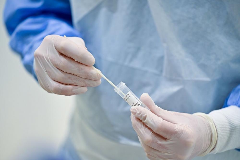 Vírus da covid-19 pode permanecer ativo por mais de 14 dias em alguns pacientes com sintomas leves