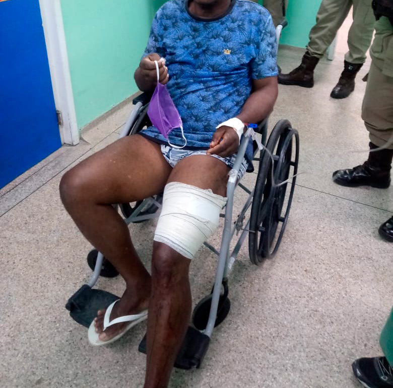 Dias d'Ávila: policial militar da reserva é baleado após discussão com vizinho 