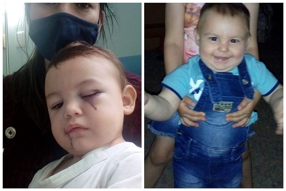 'Milagre estar vivo com tantos cortes', diz mãe de bebê que sobreviveu a ataque