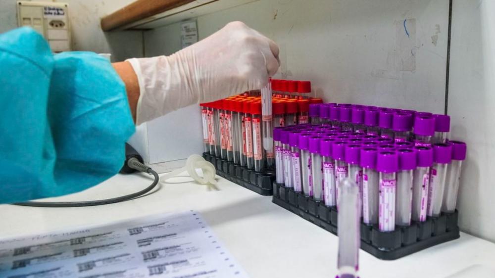 Lacen aponta aumento de 32% dos casos positivos para coronavírus na Bahia
