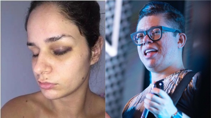 Ex-mulher de DJ Ivis publica vídeos sendo agredida por ele 