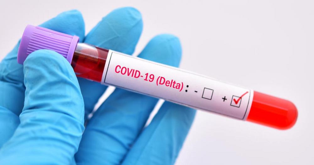 Brasil registra pelo menos 97 casos de infecções pela variante Delta