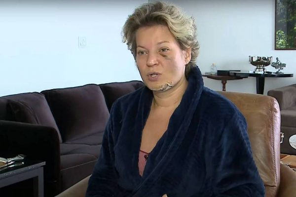 Polícia Legislativa abre investigação sobre agressão a Joice Hasselmann