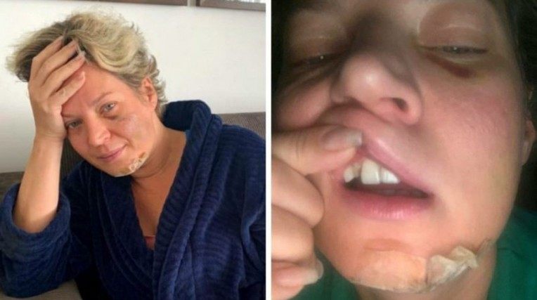 Marido de Joice Hasselmann nega agressão: 'Jamais faria isso'