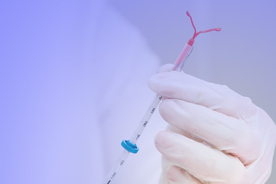 Plano de saúde exige consentimento de marido para colocar DIU em mulheres casadas