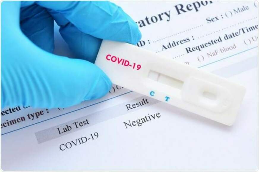 Anvisa aprova novo teste de diagnóstico para covid-19
