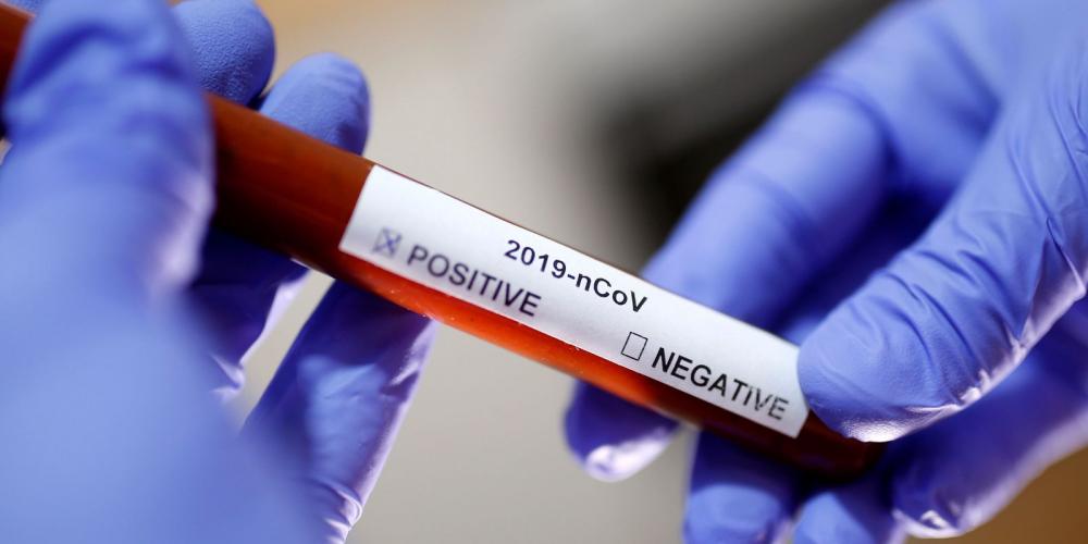 Estudo aponta subnotificação em 24,6% das mortes por Covid-19 no Brasil